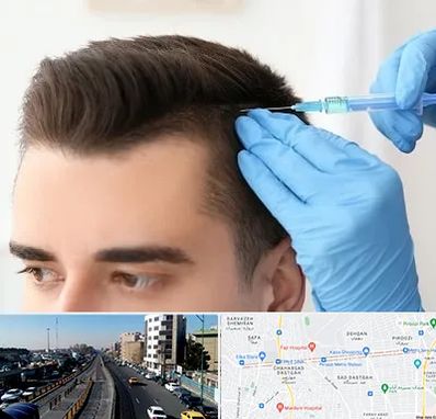 مزوتراپی مو در پیروزی