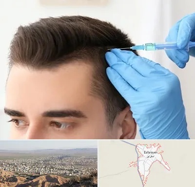 مزوتراپی مو در اسفراین