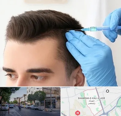 مزوتراپی مو در شهرک ولیعصر