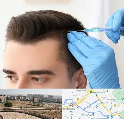 مزوتراپی مو در کوی وحدت شیراز