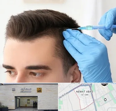مزوتراپی مو در نعمت آباد