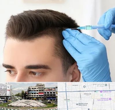 مزوتراپی مو در مرکز تهران