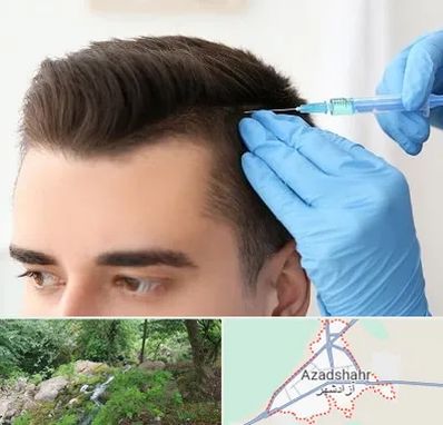 مزوتراپی مو در آزادشهر