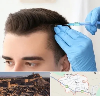 مزوتراپی مو در بم