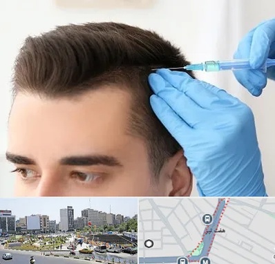 مزوتراپی مو در هفت تیر
