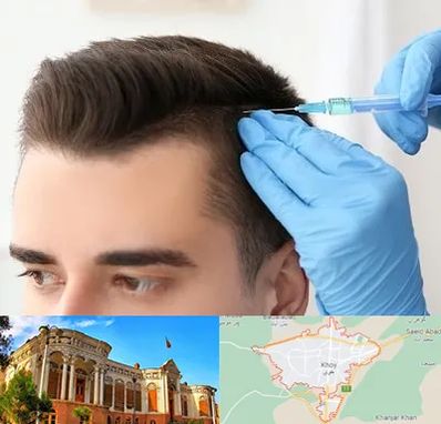 مزوتراپی مو در خوی