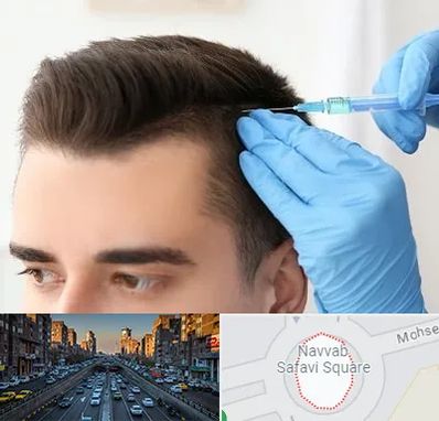 مزوتراپی مو در نواب