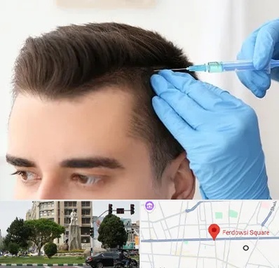 مزوتراپی مو در میدان فردوسی تهران