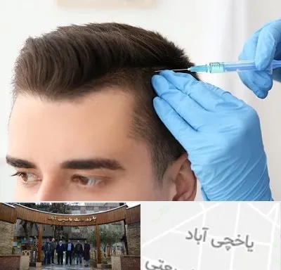 مزوتراپی مو در یاخچی آباد