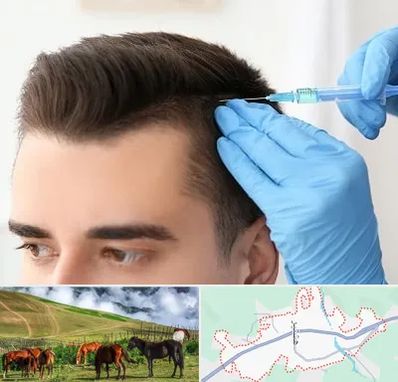 مزوتراپی مو در تالش