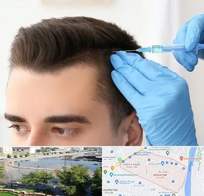 مزوتراپی مو در گلستان اهواز