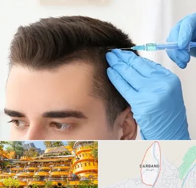 مزوتراپی مو در دربند