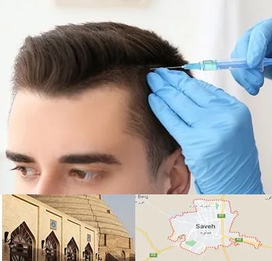 مزوتراپی مو در ساوه