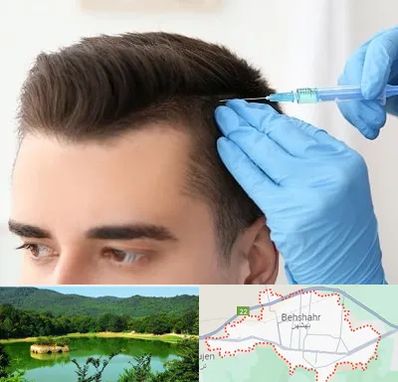 مزوتراپی مو در بهشهر