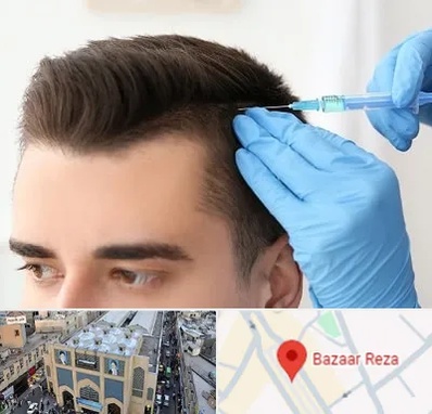 مزوتراپی مو در بازار رضا مشهد