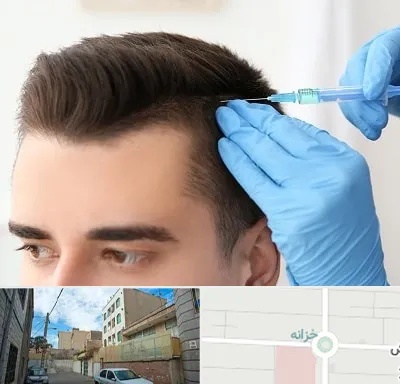 مزوتراپی مو در خزانه