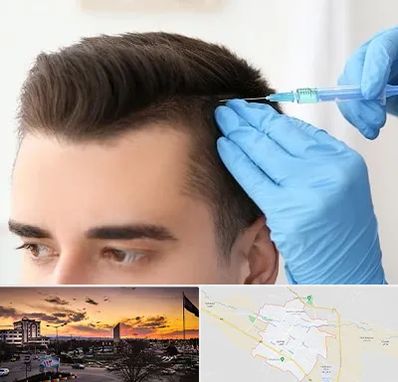 مزوتراپی مو در قوچان