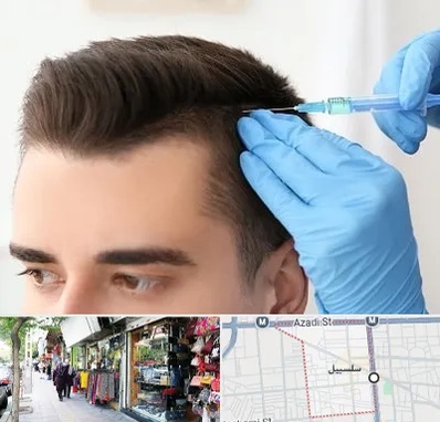 مزوتراپی مو در سلسبیل