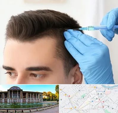 مزوتراپی مو در عفیف آباد شیراز