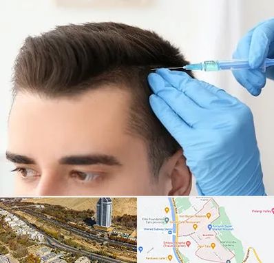 مزوتراپی مو در خیابان نیایش شیراز