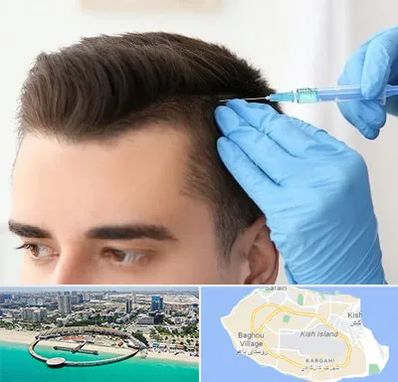 مزوتراپی مو در کیش