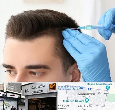 مزوتراپی مو در منیریه