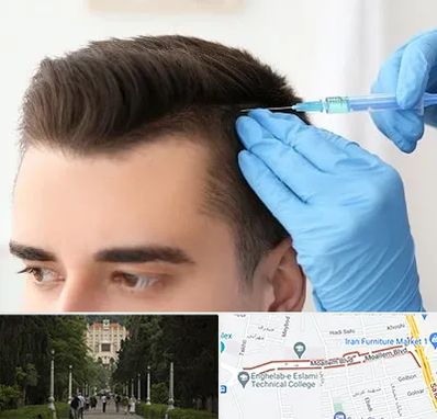 مزوتراپی مو در بلوار معلم رشت