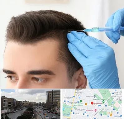 مزوتراپی مو در بلوار فردوسی مشهد