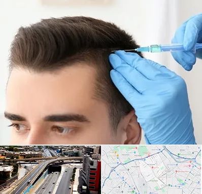 مزوتراپی مو در ستارخان شیراز