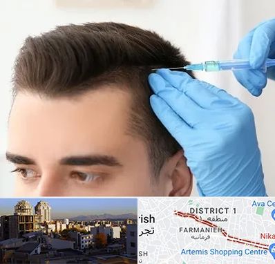 مزوتراپی مو در فرمانیه