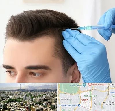 مزوتراپی مو در گیشا