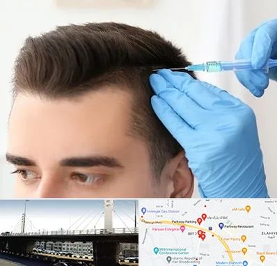 مزوتراپی مو در پارک وی