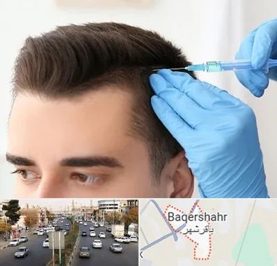 مزوتراپی مو در باقرشهر