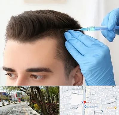 مزوتراپی مو در خیابان توحید اصفهان