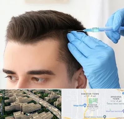 مزوتراپی مو در اکباتان