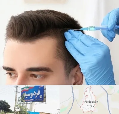 مزوتراپی مو در فردوسیه شهریار