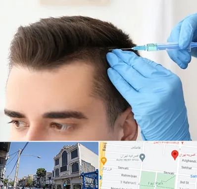 مزوتراپی مو در افسریه