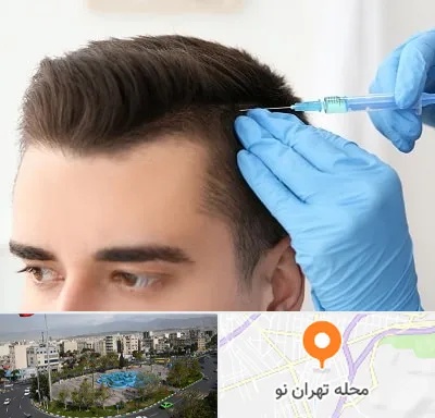 مزوتراپی مو در تهران نو