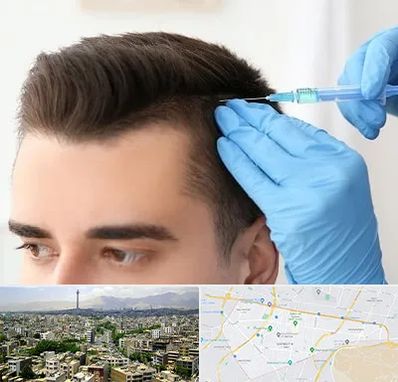 مزوتراپی مو در منطقه 8 تهران