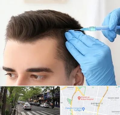 مزوتراپی مو در ظفر