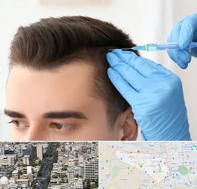 مزوتراپی مو در منطقه 18 تهران