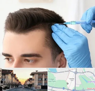 مزوتراپی مو در کوهک