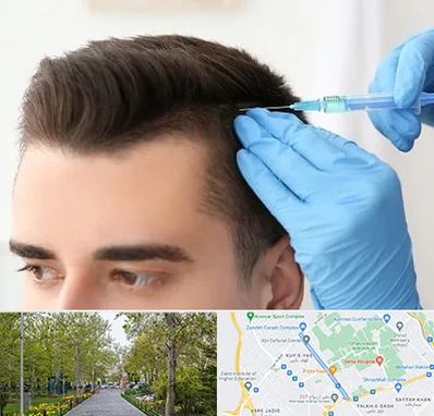 مزوتراپی مو در قدوسی غربی شیراز