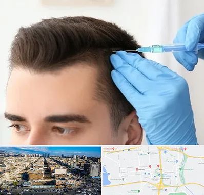 مزوتراپی مو در شهرک راه آهن