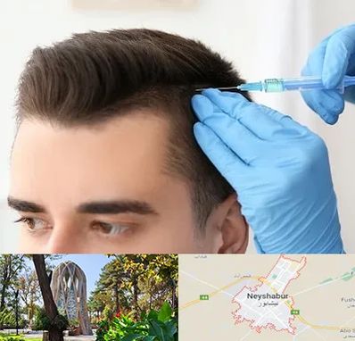 مزوتراپی مو در نیشابور