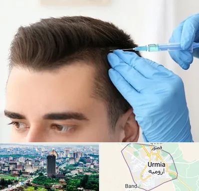 مزوتراپی مو در ارومیه