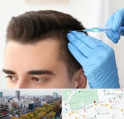 مزوتراپی مو در بلوار کشاورز