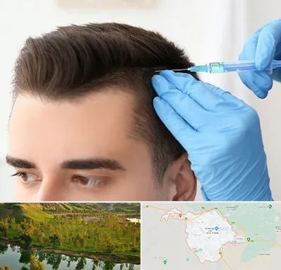 مزوتراپی مو در بهبهان