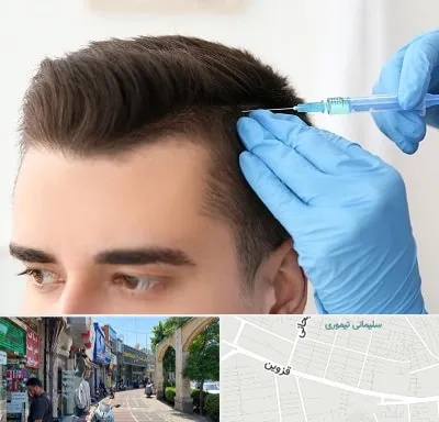 مزوتراپی مو در خیابان قزوین