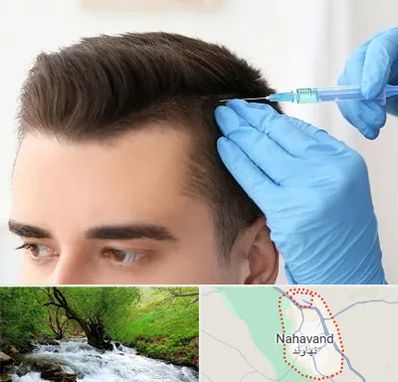مزوتراپی مو در نهاوند